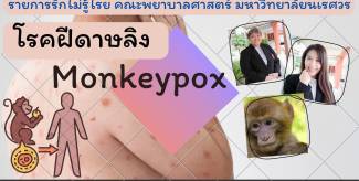 โรคฝีดาษลิง Monkeypox