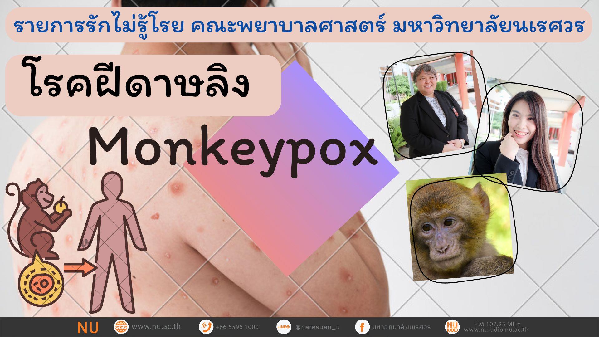 โรคฝีดาษลิง Monkeypox