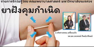 ยังฝังคุมกำเนิด